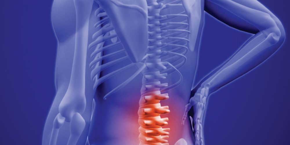 SBR-doencas-lombalgia