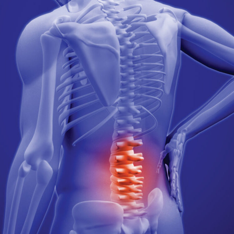 SBR-doencas-lombalgia