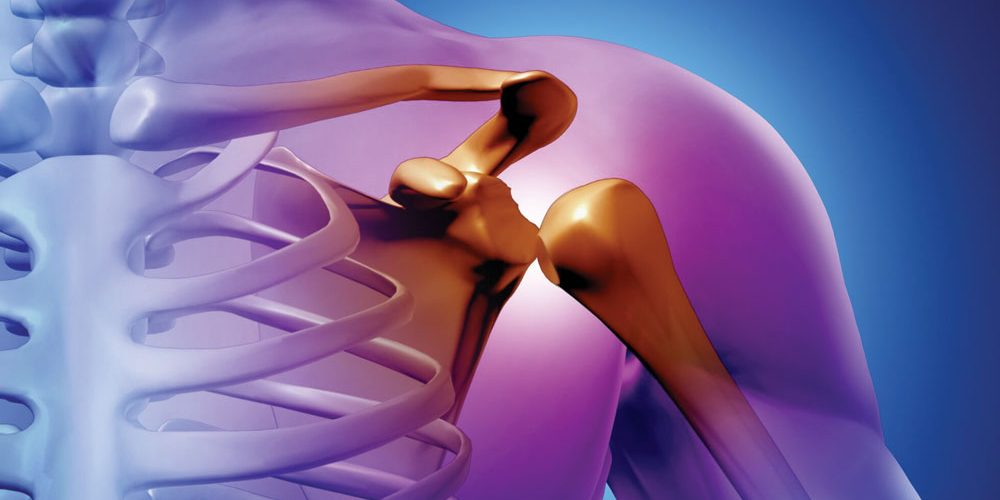 SBR-doencas-polimialgia