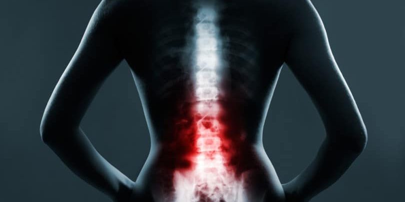 shutterstock_253280044-810×540