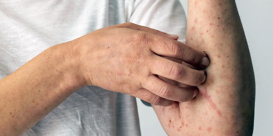 CAnçãoNova_Lupus_Freepik.com_