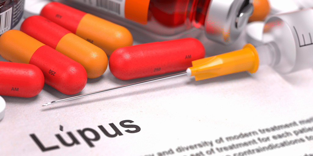 lupus